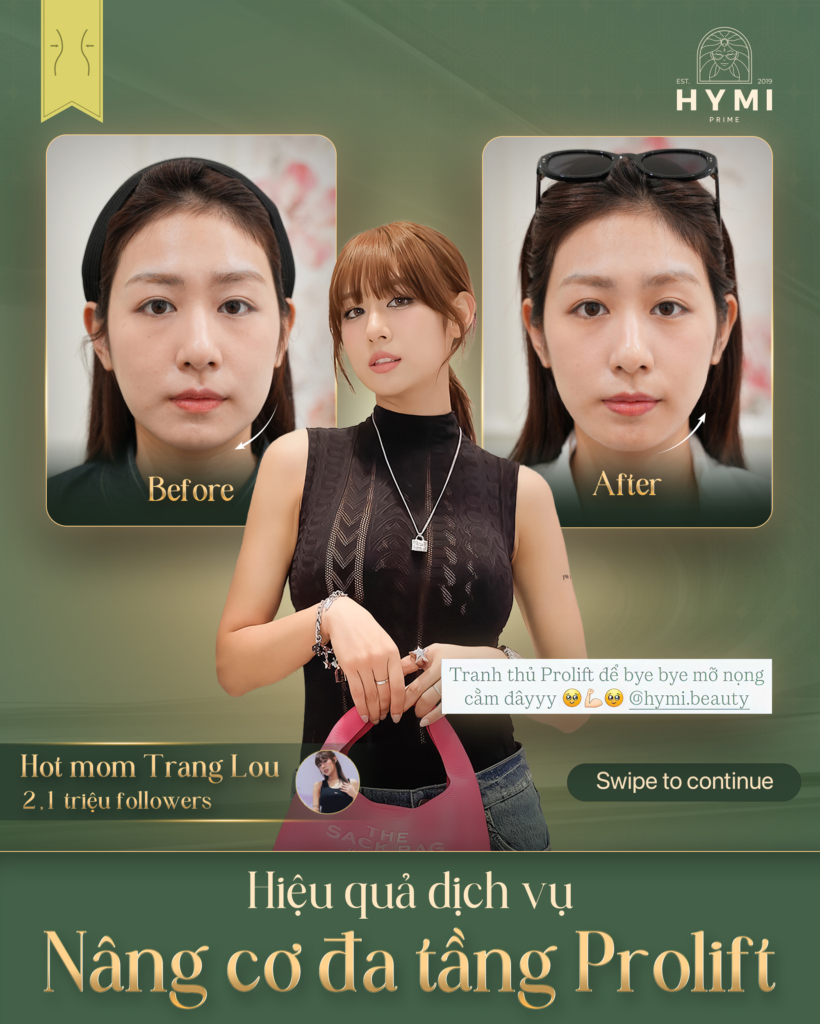 nang-co-da-tang-prolift