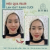 filler-ranh-cuoi