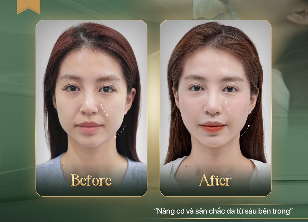 perfect-anti-aged-04