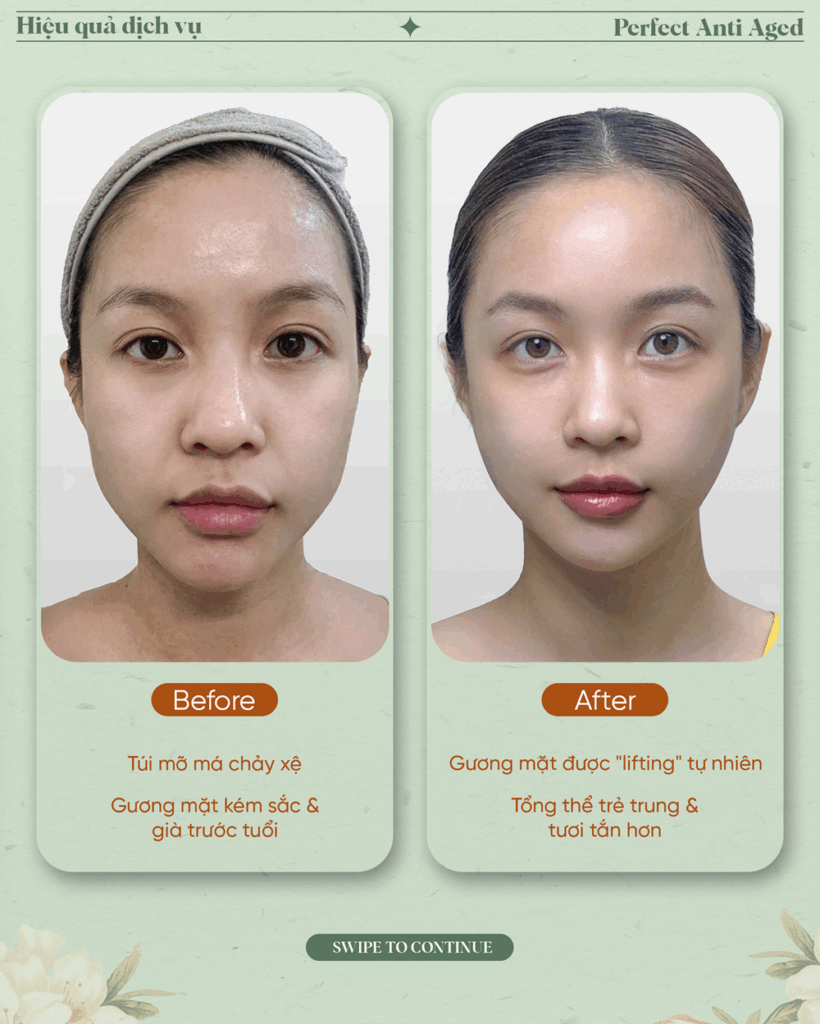 perfect-anti-aged-03