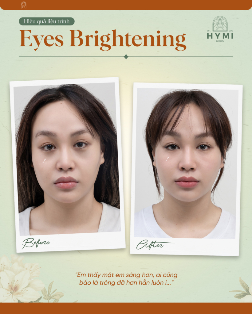 eyes-brightening-01