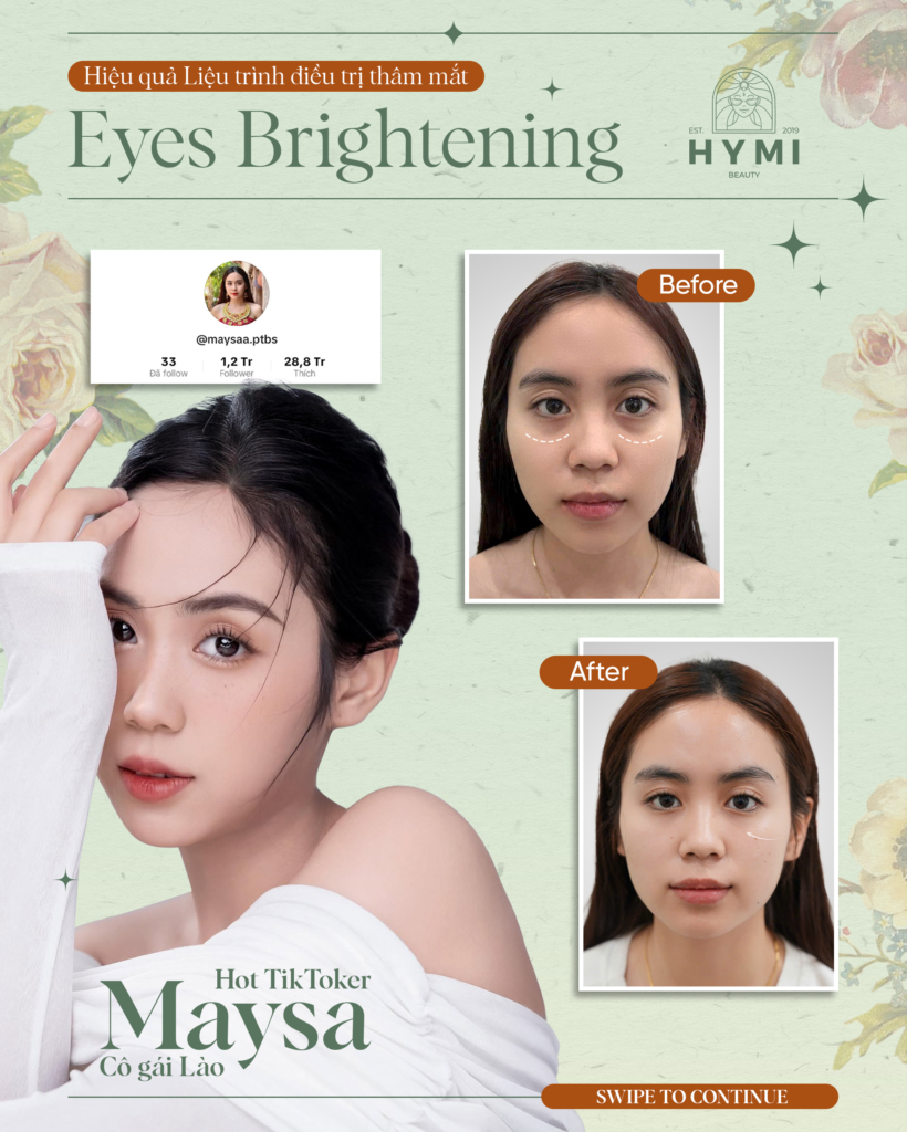 eyes-brightening