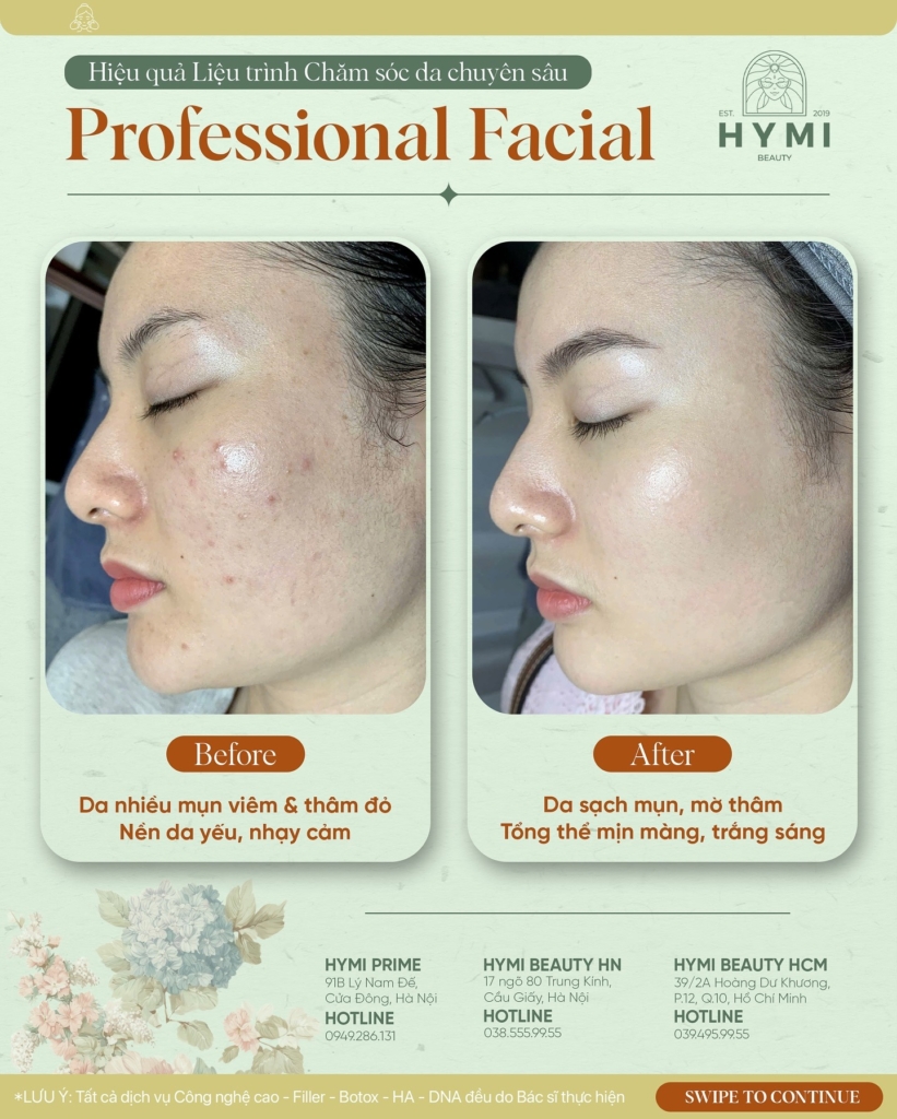 professional-facial-08