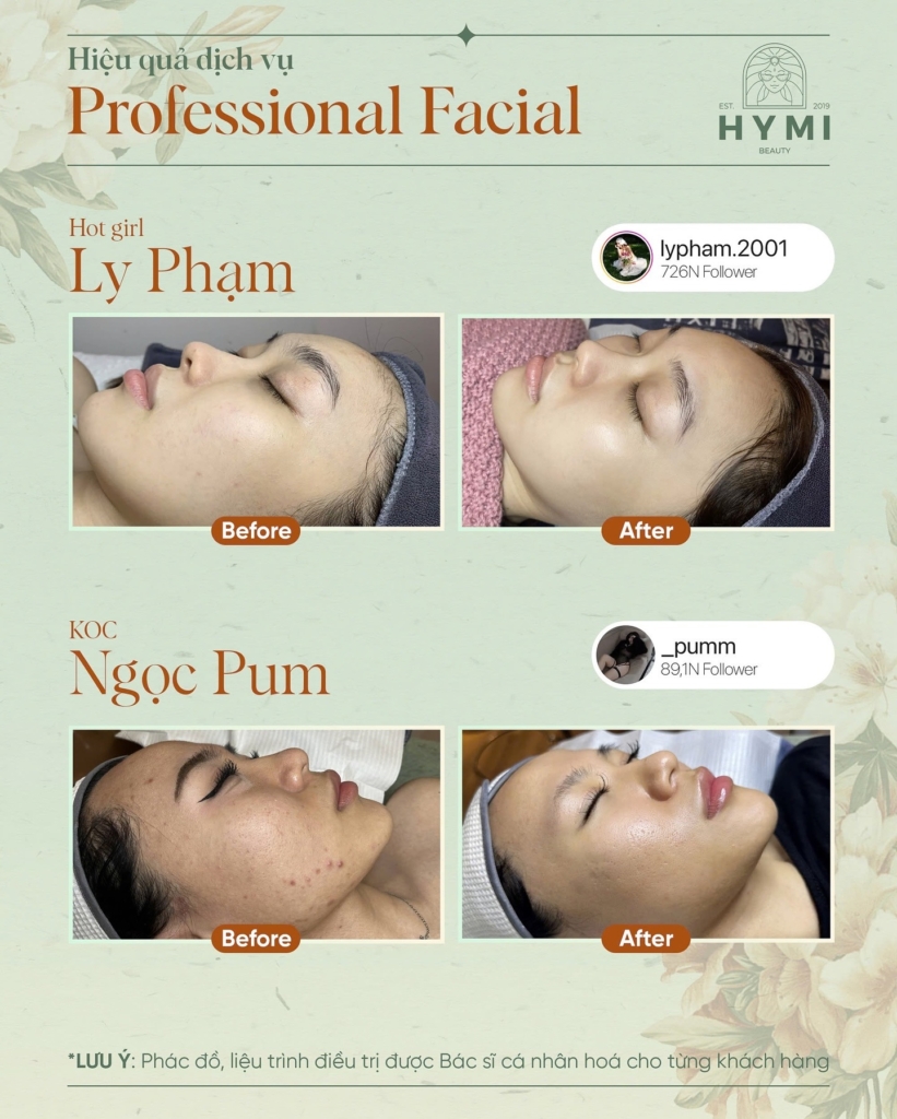 professional-facial-11